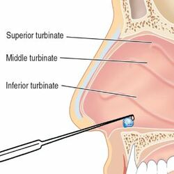 nasal